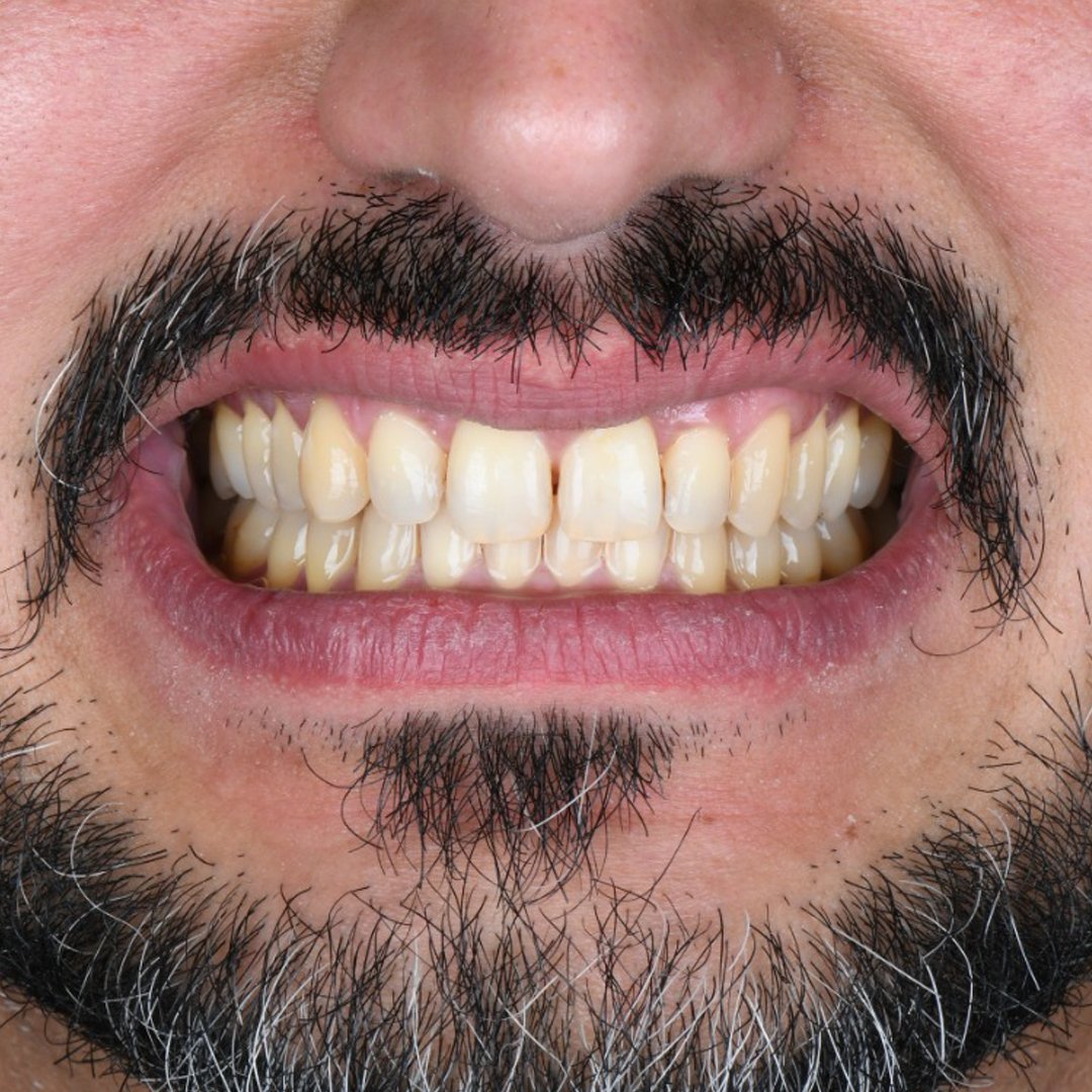 Before — Dr. Noor Mershah