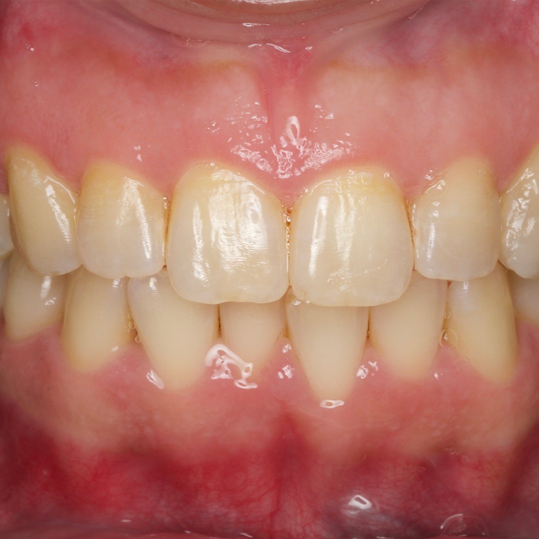 After — Dr. Noora Al-Otaibi