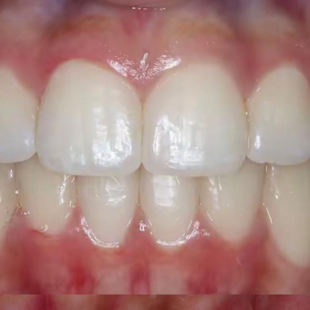 After — Dr. Rami Al-Majadi