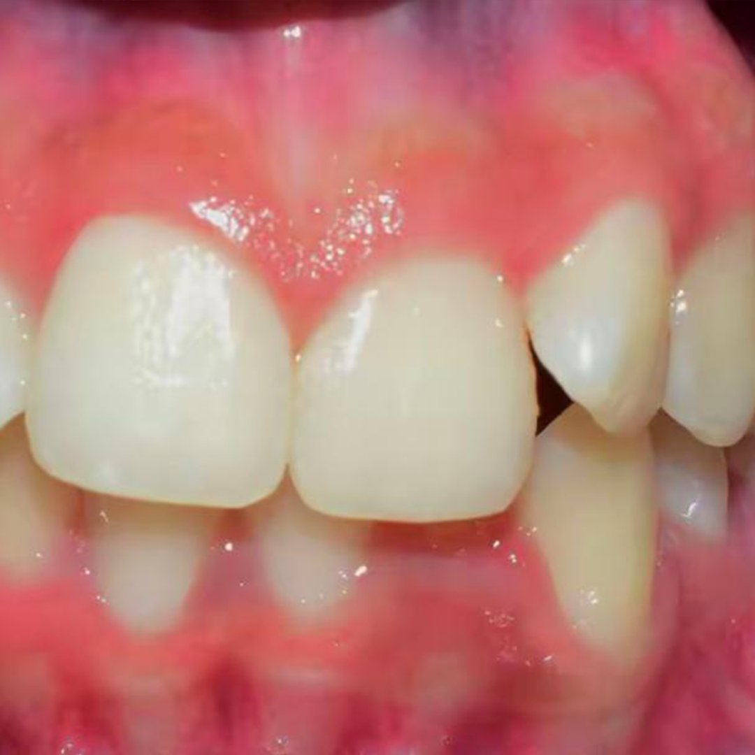 Before — Dr. Rami Al-Majadi