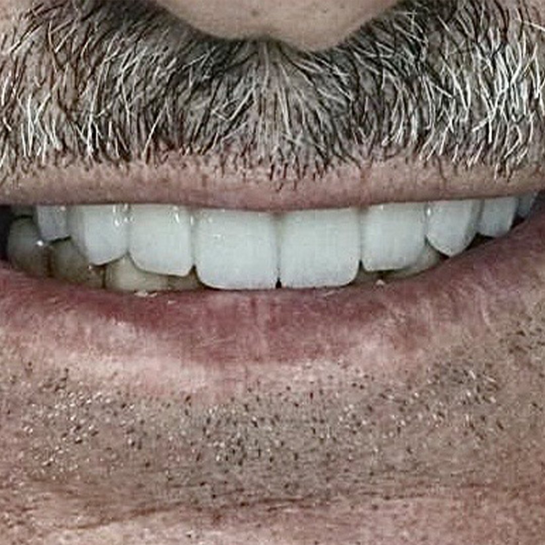 After — Dr. Wahbi Zarzour