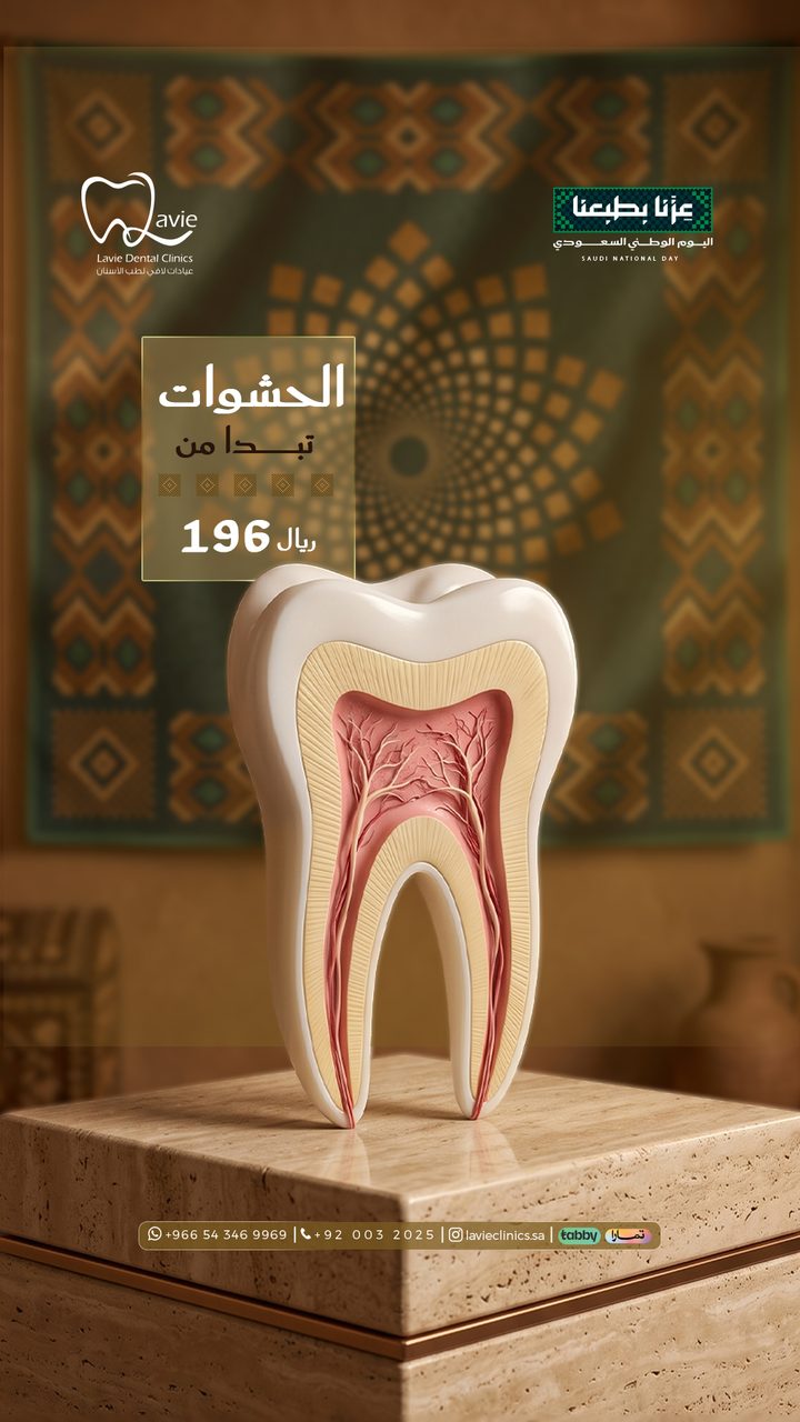 عرض حشوات الأسنان التجميلية بالرياض تبدأ من 196 ريال، عيادات لافي