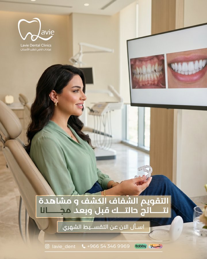 Clear aligners - free consultation + before/after preview